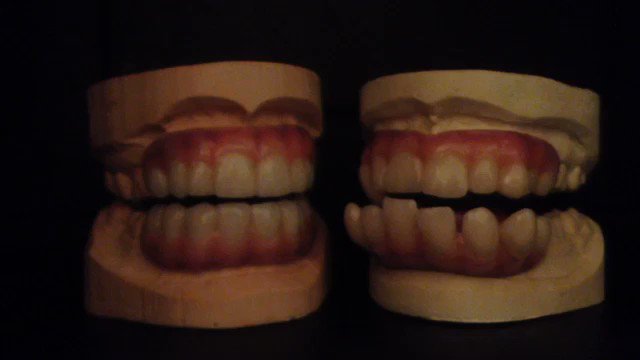 Chomping at the bit for Halloween to get here... at least the teeth for my costume are ready! ???????????? #heidihalloween https://t.co/gsJB2B1DtX