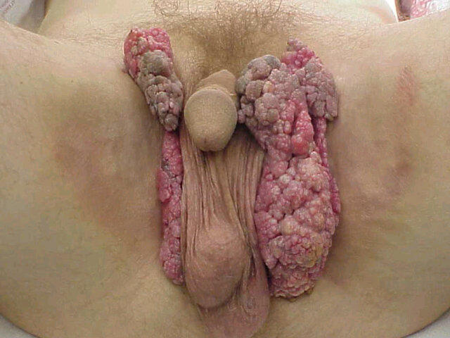 sexy xxx naked pics from Apollo tattoos on pussy lips