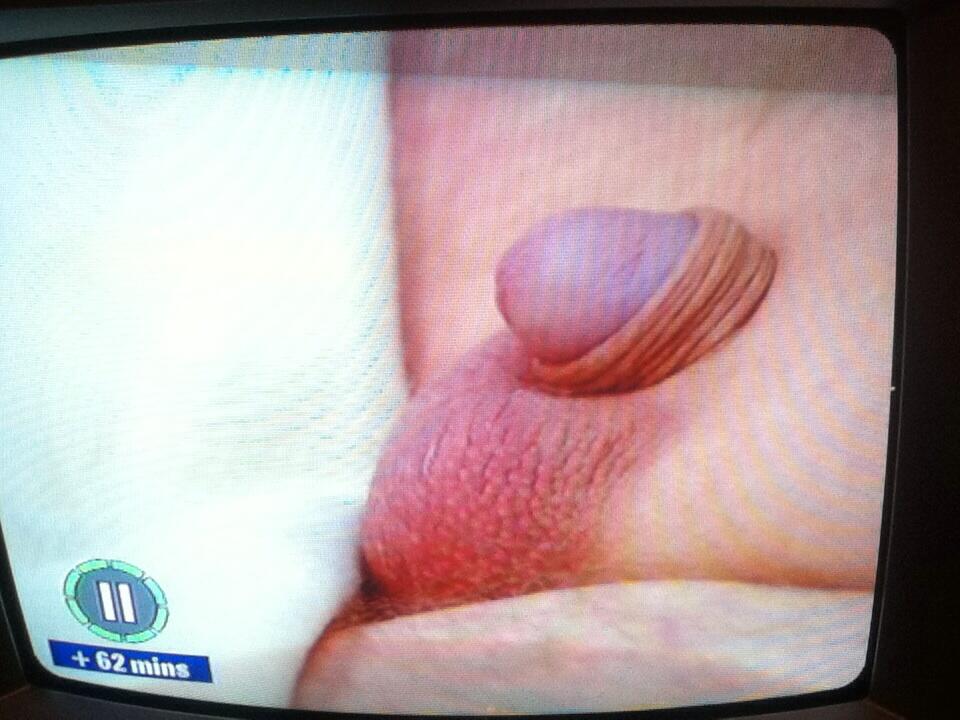 How do you know who have a small penis