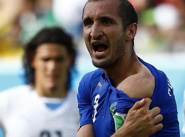 Chiellini showing where he was bitten [via AFP]