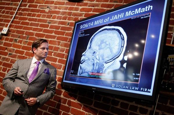 Attorney Chris Dolan presents MRI scans as evidence that 13-year-old Jahi McMath is still alive. (@SFChronicle/Twitter)