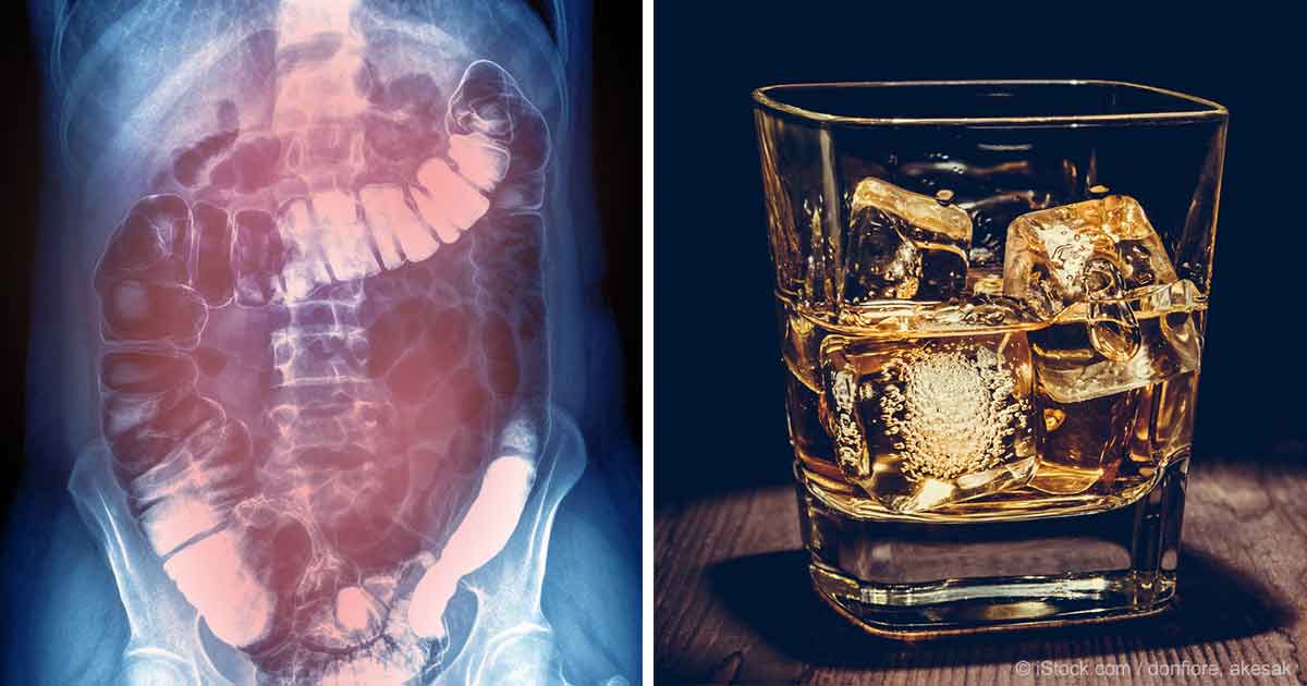 The Evidence on the Effects of #Alcohol on Your Body https://t.co/CBVq4f3MzK by @mercola https://t.co/1n5mgK411y