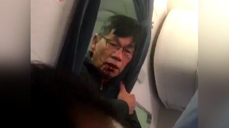 RT @Gizmodo: 'Just kill me': horrifying new video shows United passenger covered in blood https://t.co/FqXLLtXaJJ https://t.co/1TDdORnww5