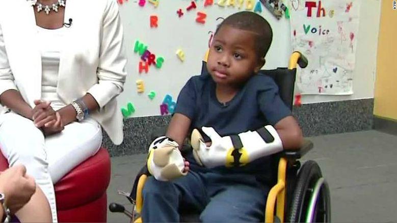 RT @EarlyStart: After 10 hours and 12 surgeons, a Baltimore boy becomes 1st to receive new hands: http://t.co/8pI7Jfc9G9 http://t.co/JgffvG…