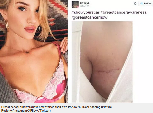 2019 year - Breast Cancer Survivors Bare Their Scars 2019 year