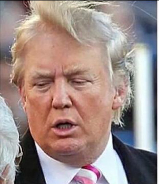 HAVE NEVER SEEN THIS,BUT(THIS IS NO JOKE)THE DONALD HAS NICE
FOREHEAD & SURPRISINGLY
ATTRACTIVE HAIRLINE.#Hair2Spare https://t.co/MVqdWsTCBb
