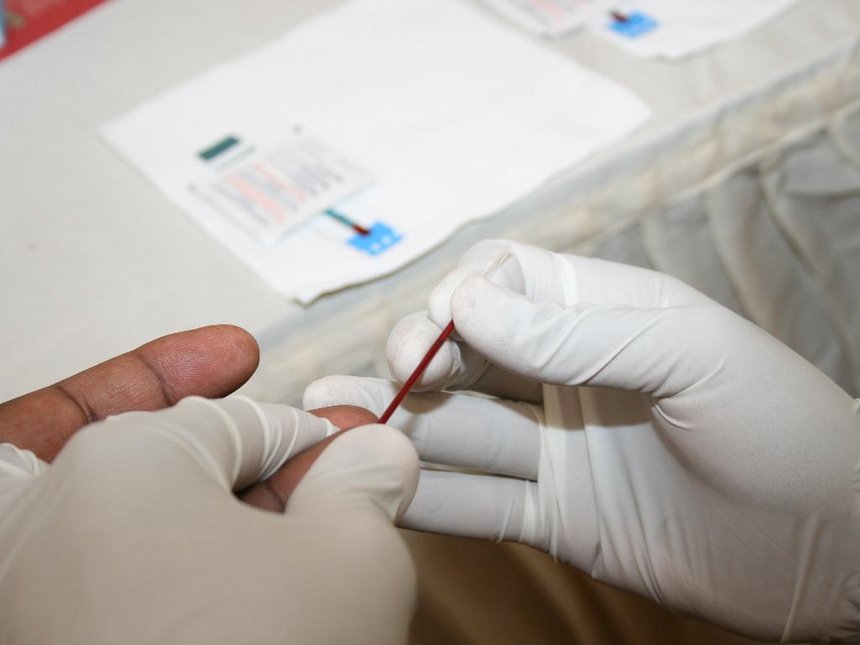 HIV patients aged 20 diagnosed today will live into their mid-70s