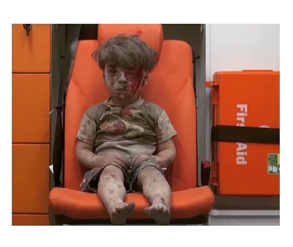 Heartbreaking to look at this 5 y/o child, Omran. War is all he has ever known. Let's help: https://t.co/hiPAMhvh8v https://t.co/vI3es8f2oB