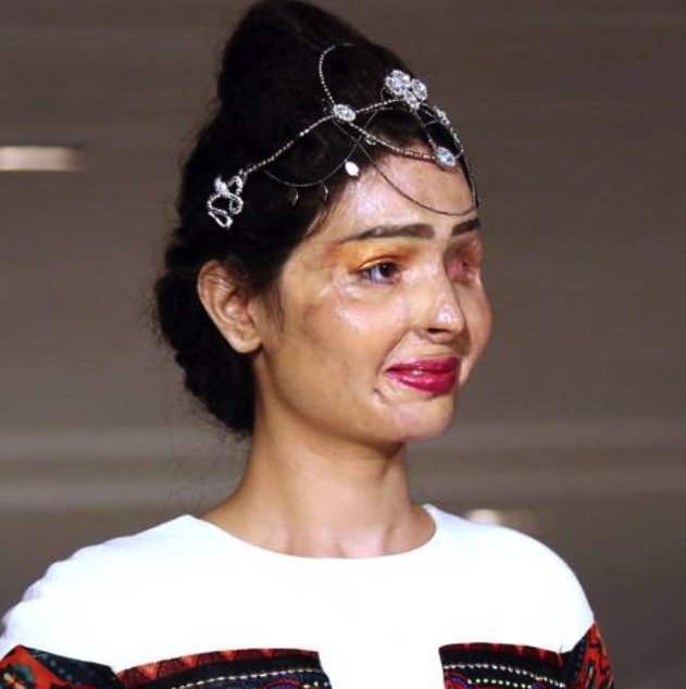 RT @wesleysnipes: Acid attack survivor #ReshmaQureshi walked the #NYF runway again! Don't let anyone take your smile away young lady! https…