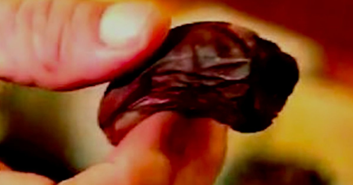 Canadian Hotel Wants To Get Its Hands On Whoever Stole Human Toe