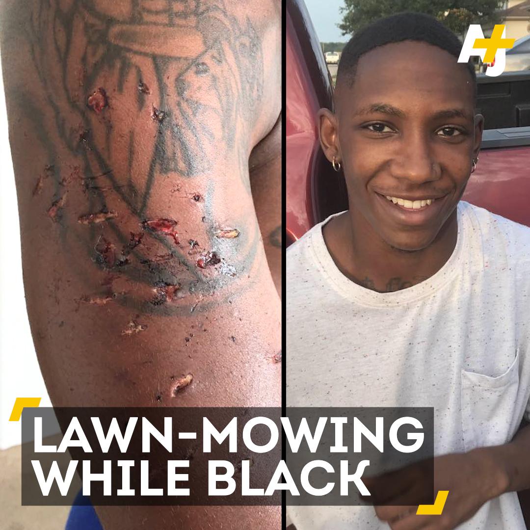 RT @ajplus: A young man was attacked with a K-9 and tasered after he was stopped by police while mowing lawns. https://t.co/mPnGUtypTl
