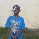 Detroit's high rate of shootings often scars innocent children