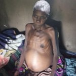 Bungoma widow seeks cash to treat stomach problem