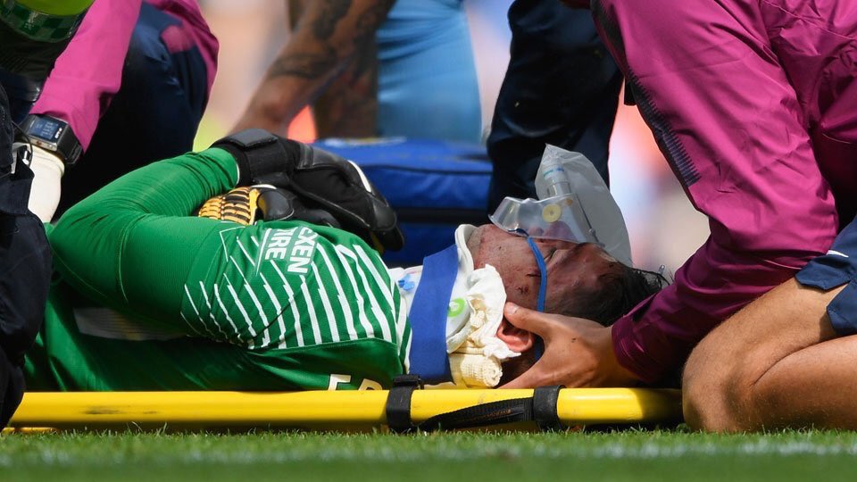 Ederson