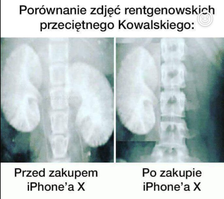#iPhoneX