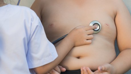 'Their voices haven't been heard': Hospitals are ill-equipped to treat obese patients, experts say