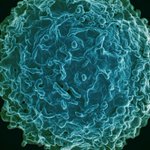 With $10.5M, Jackson Lab Joins Study Of Chronic Fatigue Syndrome