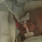 Baby dies after funeral for mom, who refused chemo to save her