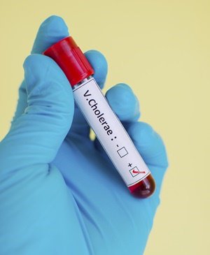 Over 50 people die in Chad cholera outbreak