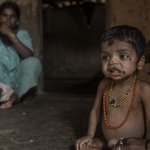 India worse than Nepal, Bangladesh in tackling hunger; down 3 ranks at global level: Report