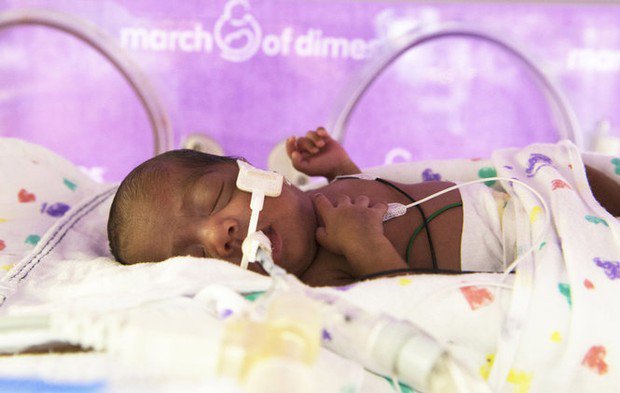 the impact of premature birth on child development Premature birth has long-term effects premature birth has consequences for children right into only 14% of men and 25% of women had had their own child. the impact of premature birth on child development Premature birth has long-term effects premature birth has consequences for children right into only 14% of men and 25% of women had had their own child.