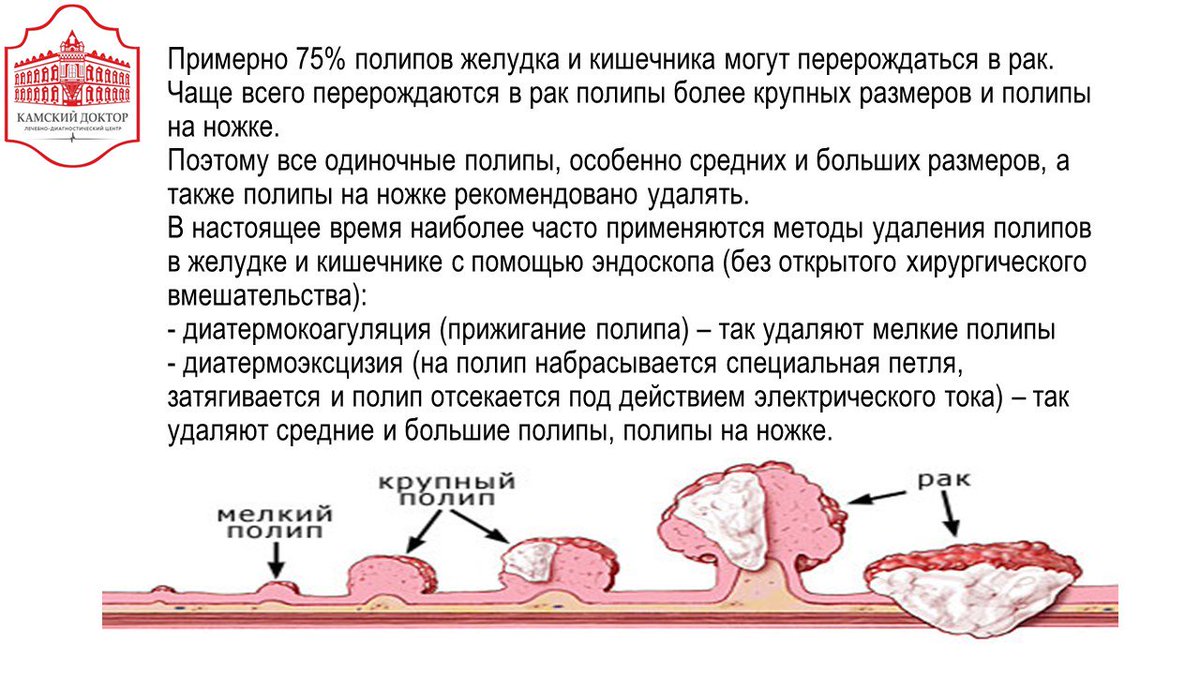 Полип Кишки Диета