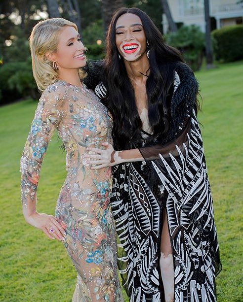 Love my girl @WinnieHarlow. ❤️ https://t.co/5SCsxPmU0V