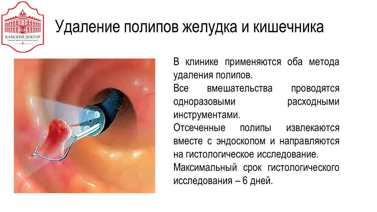 Диета После Удаления Полипа В Кишке