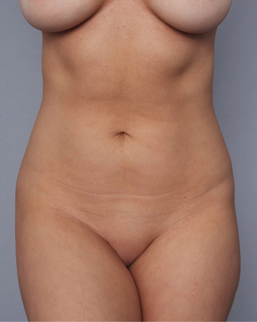 11.02.18 #KKWBODY https://t.co/X6YBB9w1vr