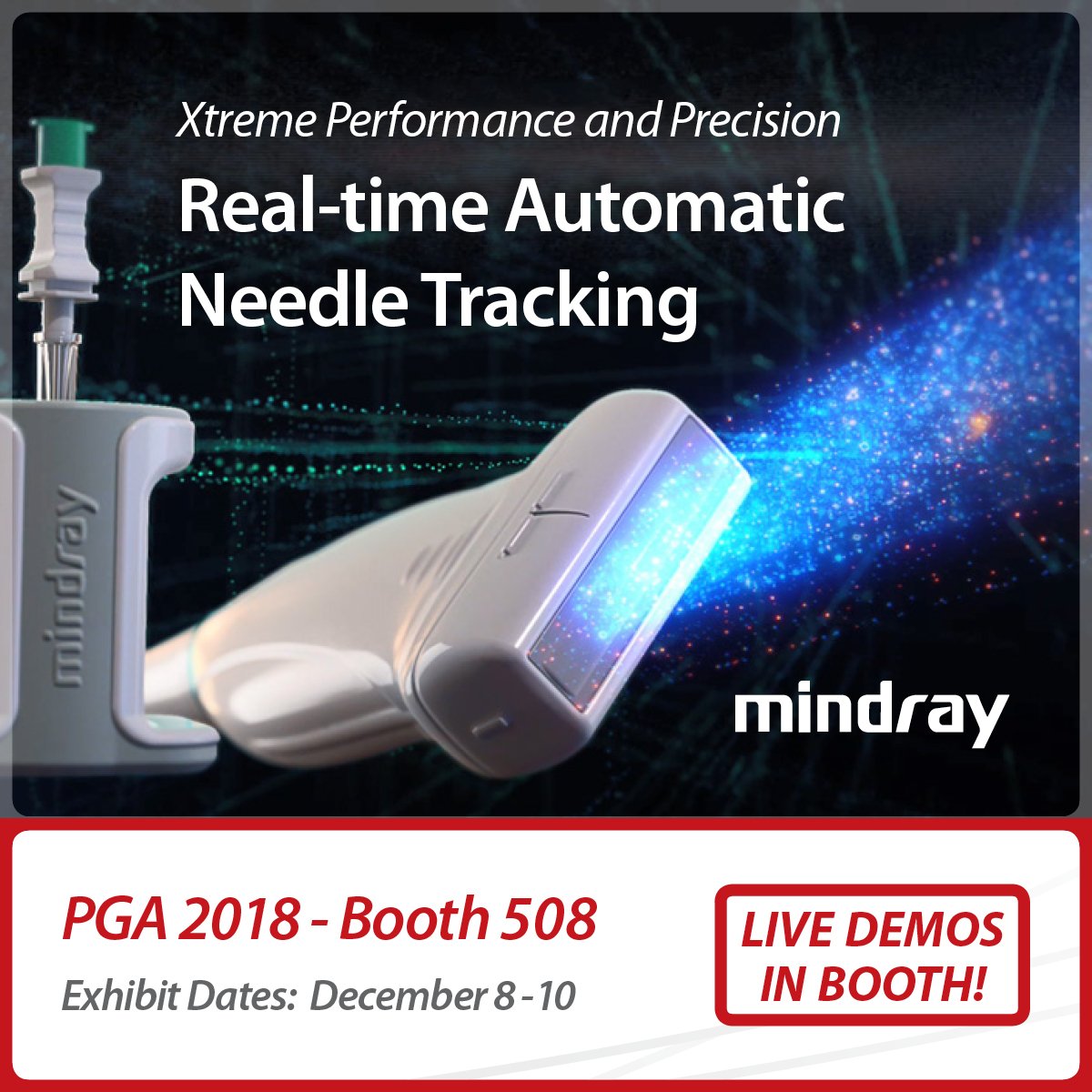 Attention attendee's of #PGA72 Don't miss your chance to see live demos of our new eSpacial Navi™ needle tracking technology! Find #Mindray at booth 508 today and tomorrow and be sure to bring a friend! https://t.co/QoaJY6gcUb