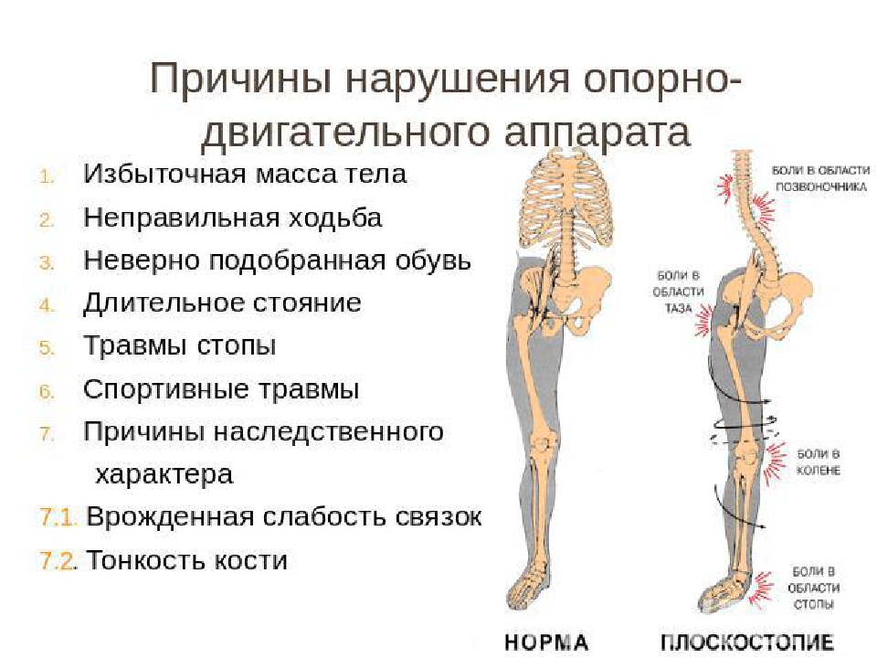 Лишний Вес Нагрузка На Позвоночник