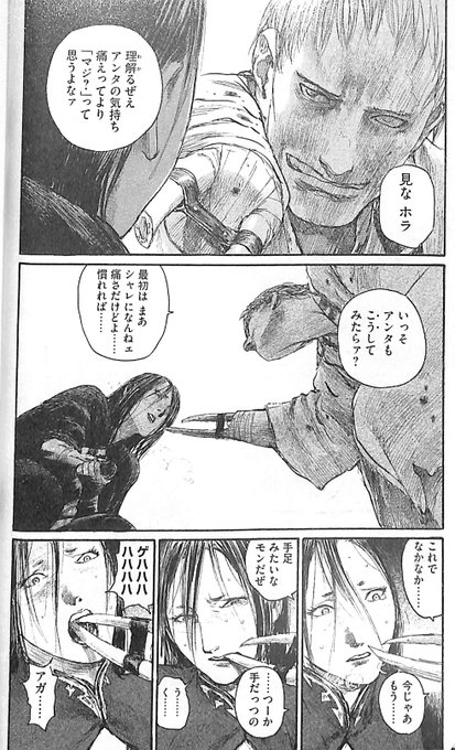 尸良のこの手の骨を見るたびにKrukenberg Hand(クルーケンベルク義手)を思い出す。第一次大戦時にドイツのKr 尸良のこの手の骨を見るたびにKrukenberg Hand(クルーケンベルク義手)を思い出す。第一次大戦時にドイツのKr