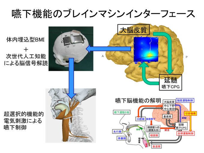 『中二病でも恋がしたい』において、異次元の固有結界が出てきます。脳にBMI（ナノチップ）を埋め込んで、５Gで脳に幻覚（電