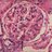 nephropathyIGA