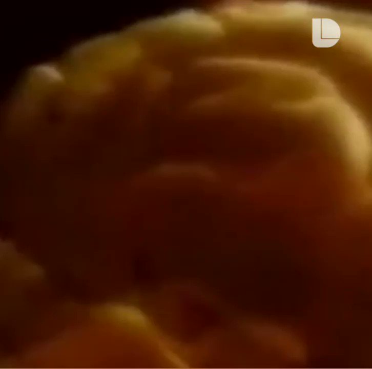 El 24 de mayo México conmemora el Día Nacional de la EpilepsiaMás noticias en http://lopezdoriga.com