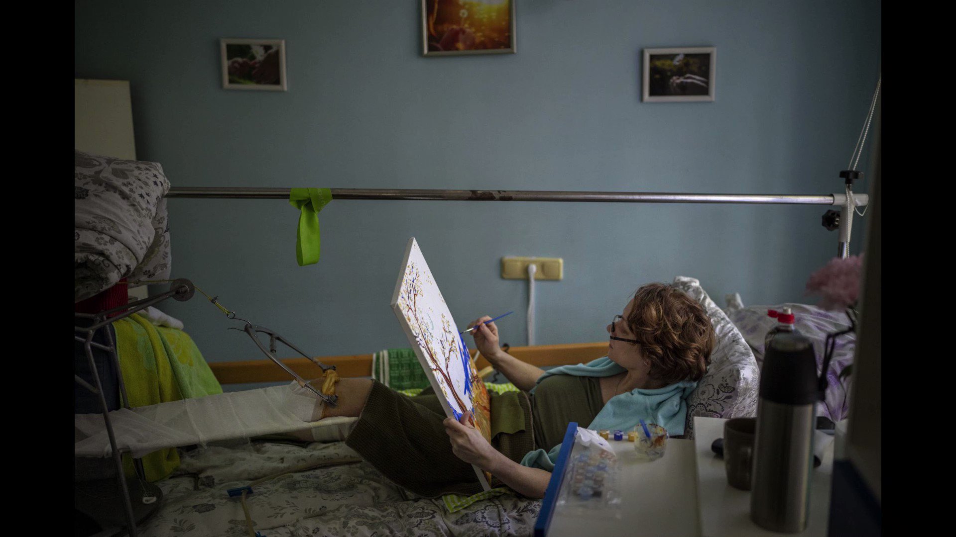 @AP_Europe: The stories of people who undergo amputations during conflict are as varied as their wounds, as are their journeys of reconciliation with their injuries. Photos by @EmilioMorenatti reporting from Ukraine.More: