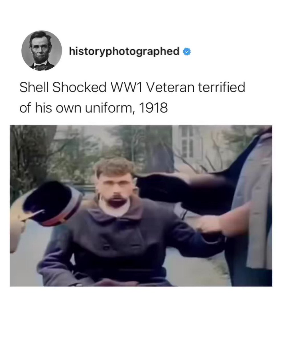 History Photographed on X: Shell-shock is an old-fashioned term
