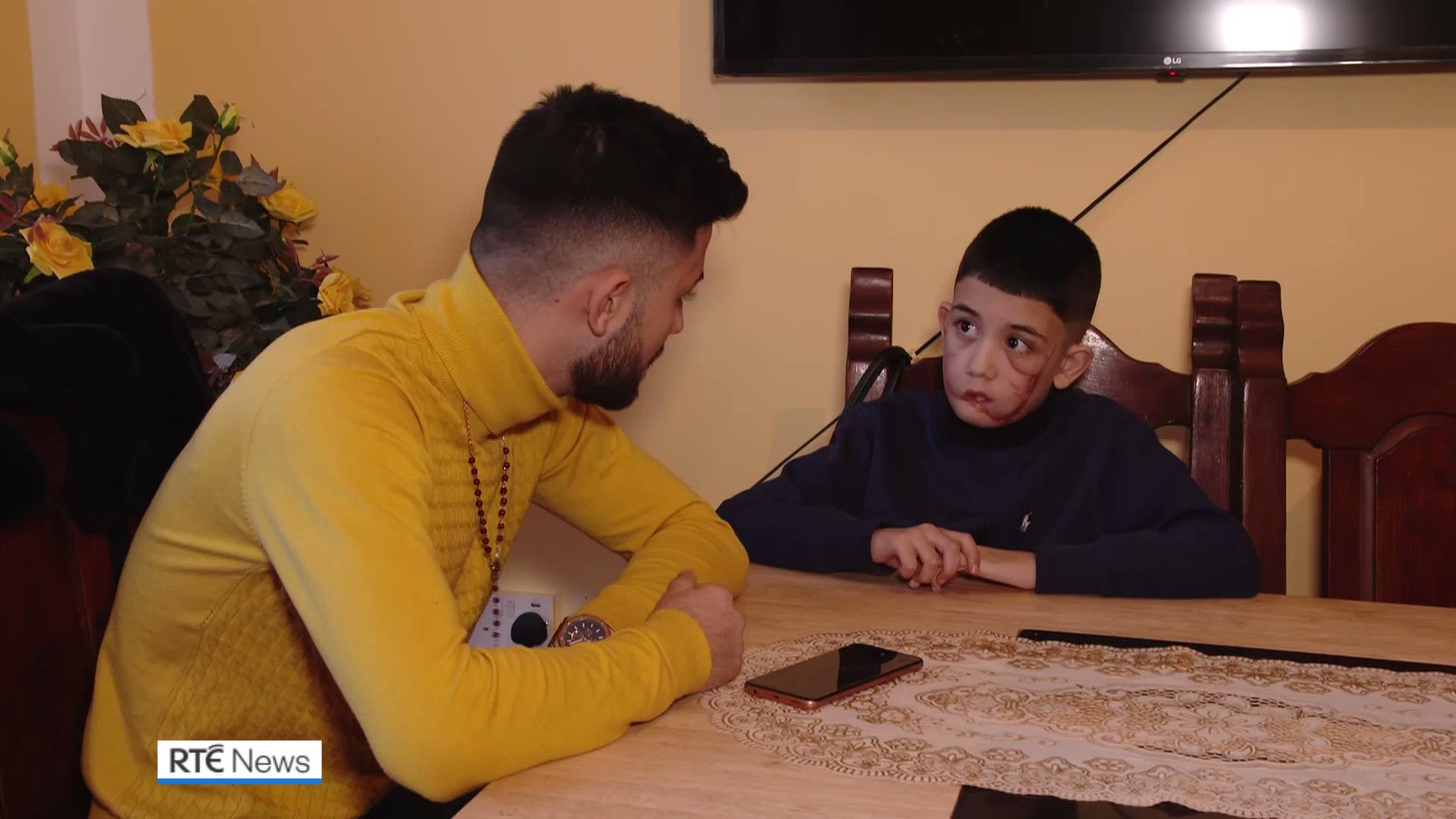 RTÉ News on Twitter "The family of a boy attacked by a dog in Wexford