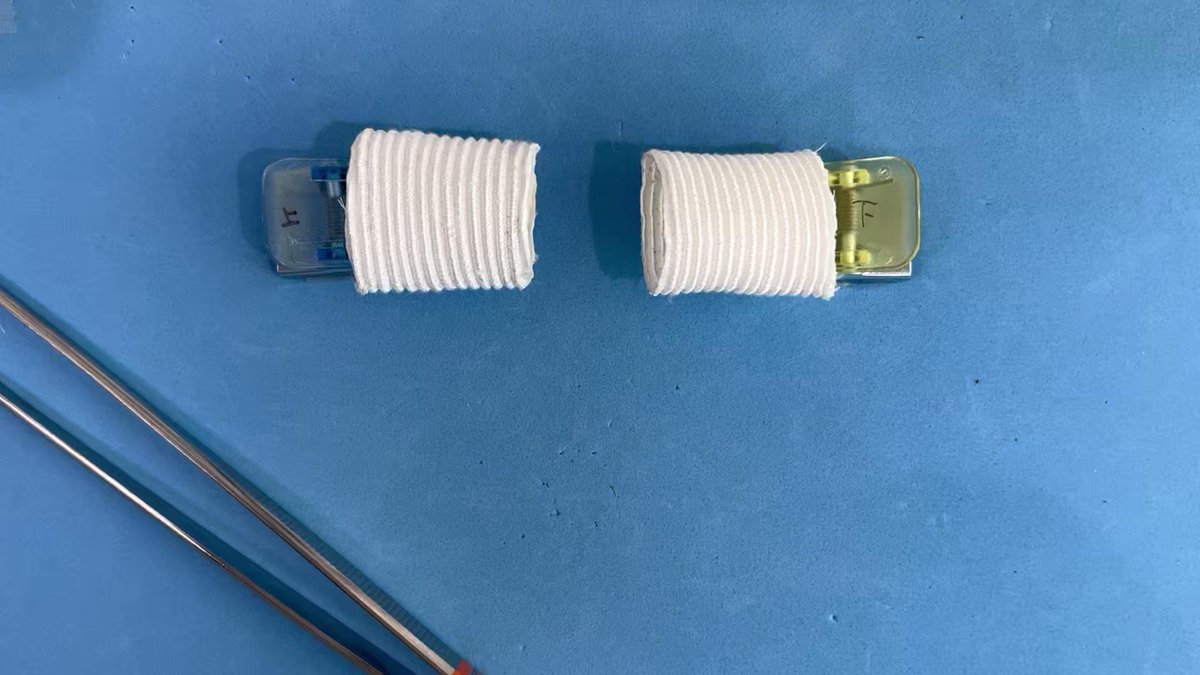 他のタイプの腸吻合術