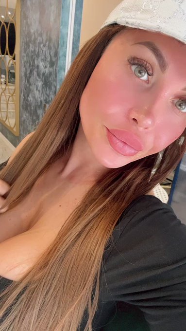 2 pic. Red face after my micro needling session today ?️? Skincare Day ? https://t.co/fmzG0Ozg4B
