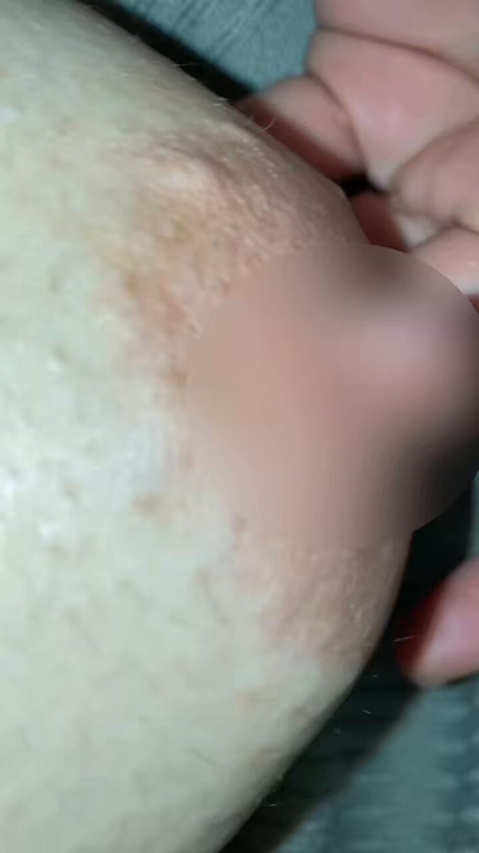 おっぱい観察してみたら毛が生えてて萎えたって話 https://t.co/WmjVAeqyeL