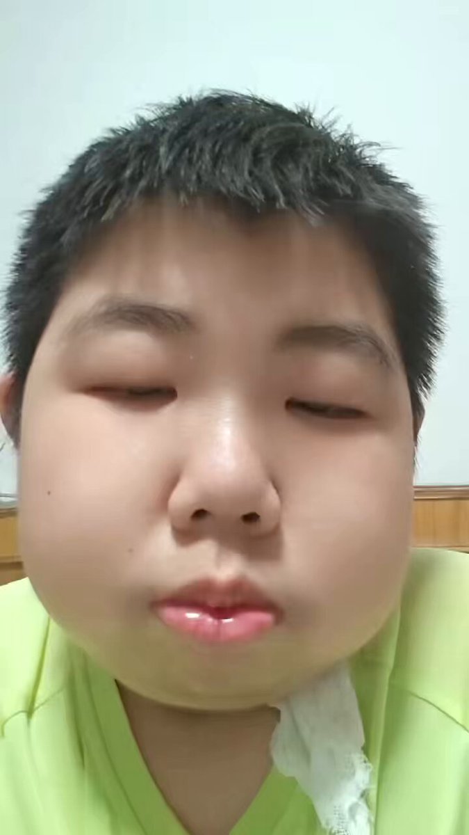 媒体预览