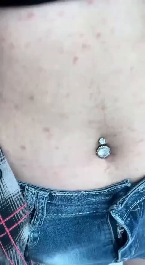 好恶心🤮
原来这就是梅毒，二期梅毒🤮 