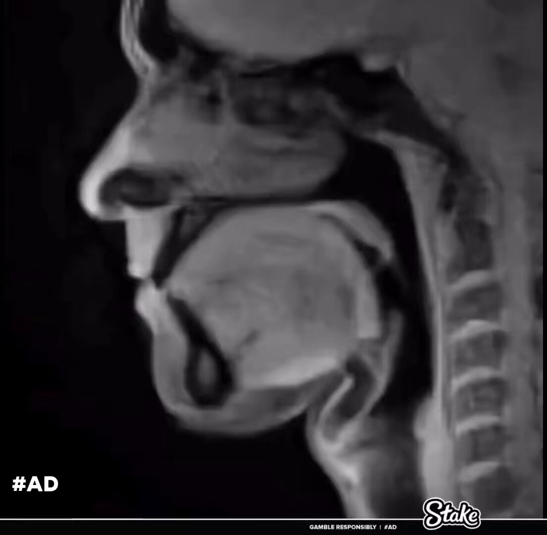 Real time MRI of a person talking 