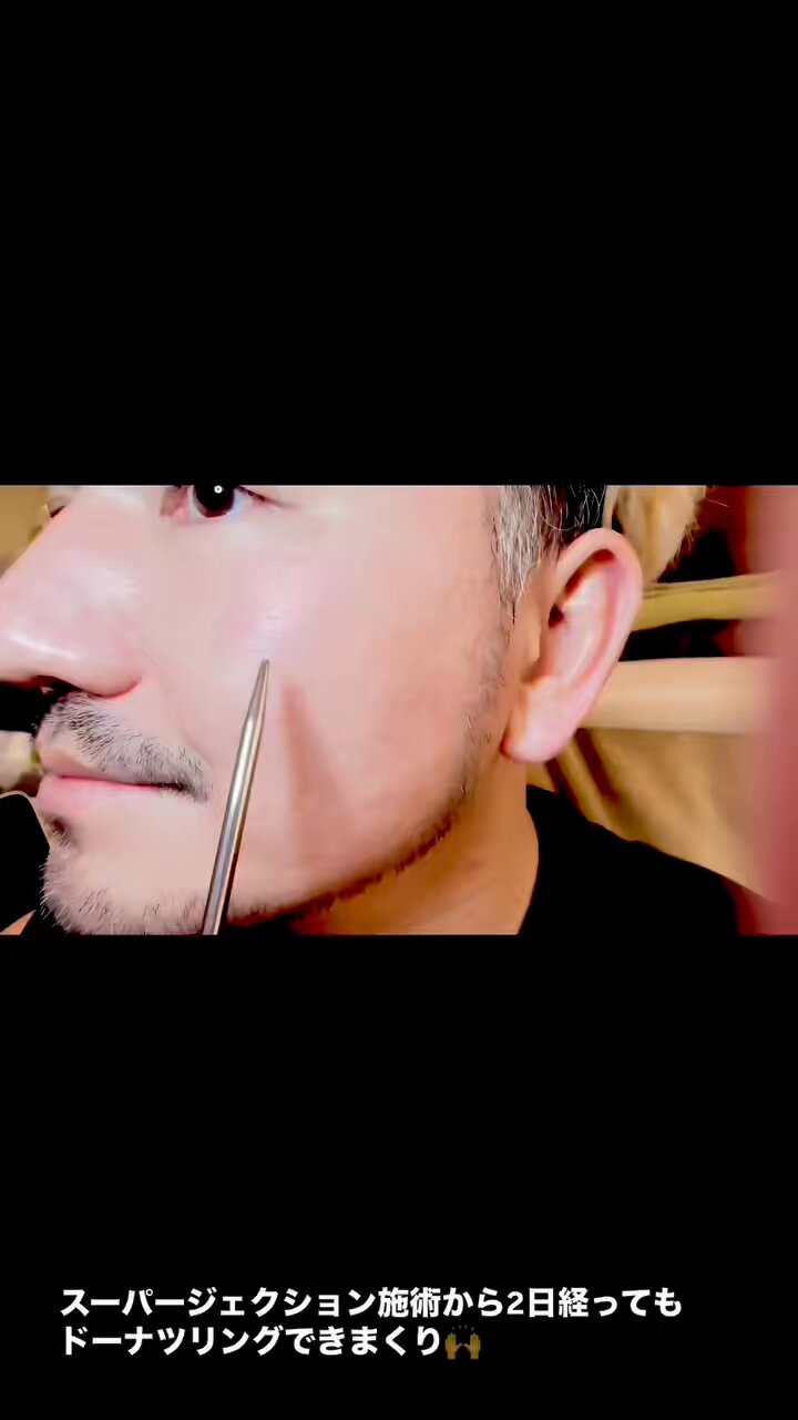 nagomi コスメ・美容 韓国 スーパージェクション Pharmesthetic