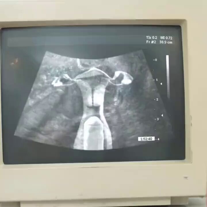 医院体检偷拍直男    