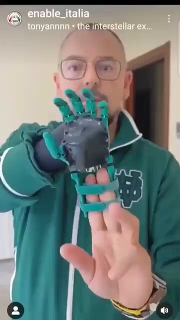 Imagine prosthetics in 5-10 years. Massive advancement in dexterous hands from humanoids coupled wit