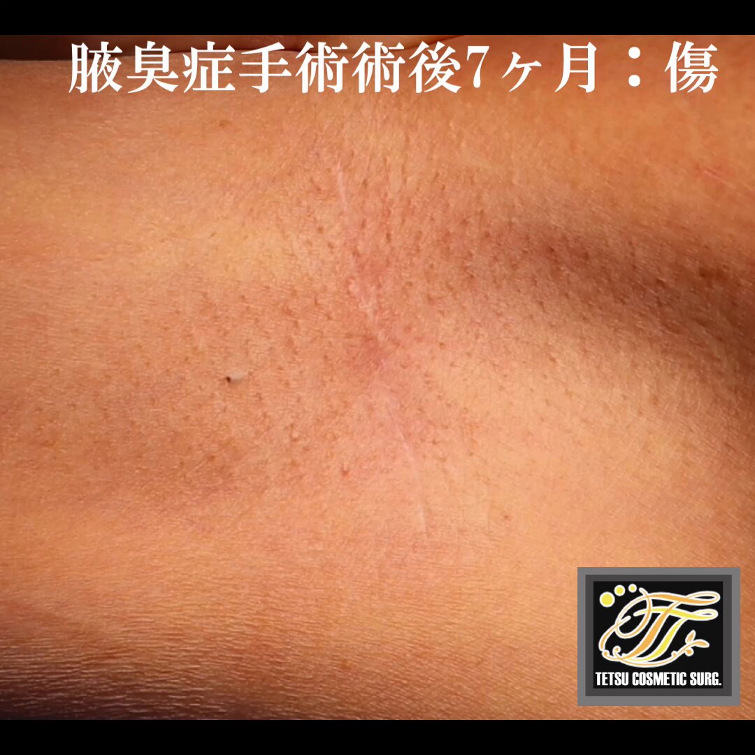 田中哲一郎 (@tetuichiro_prs) / X