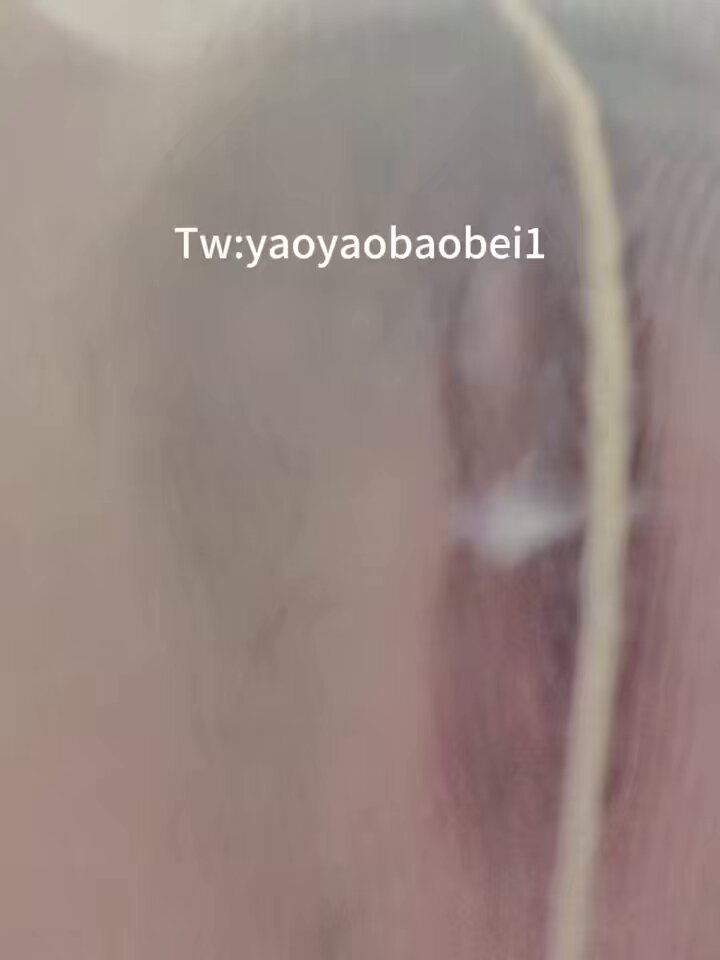 媒体预览