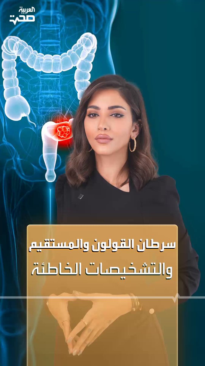 #سرطان_القولون و #المستقيم.. غالبا ما يتم تشخيصه بشكل خاطئ بسبب خلط أعراضه مع أعراض أمراض أخرى #صحة _صحة